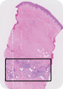 Histologia BTM: 8 meses