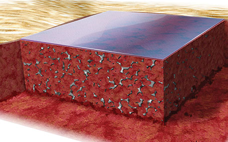 NovoSorb® BTM totalmente integrado